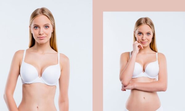FixBody: Είναι η θεραπεία λιπόλυσης που αναμορφώνει θεαματικά το σώμα