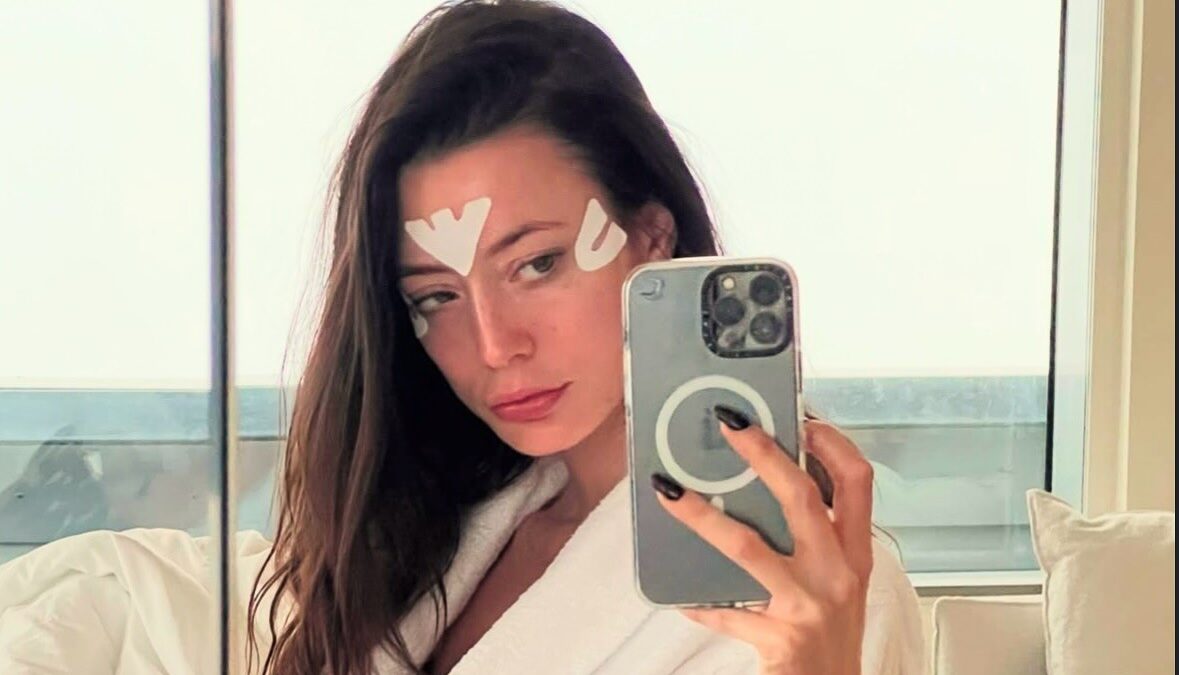 Face taping: Βήμα – βήμα η τεχνική και τα σωστά tips για αποτέλεσμα lifting και μείωση ρυτίδων
