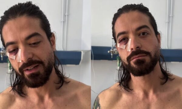Άρης Μουγκοπέτρος – Συγκλονιστική αποκάλυψη στο Live News: Μόνιμη βλάβη στο μάτι του – Θα βλέπει μόνο στο 10%