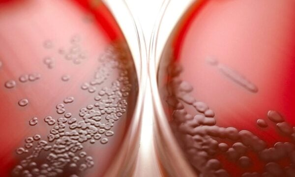 Στρεπτόκοκκος: Πότε επιβάλλεται το Strep Test – Πότε είναι αναγκαία η αντιβίωση