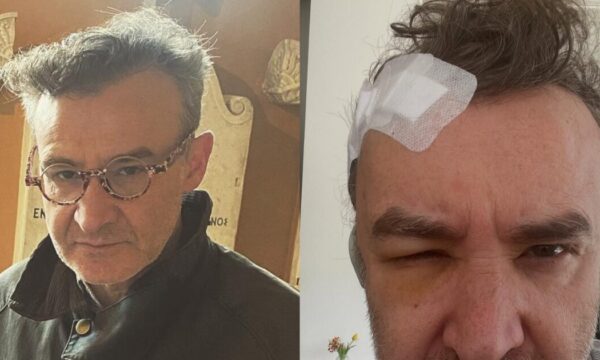Νίκος Ορφανός: Το συγκλονιστικό μήνυμα μετά τη σοβαρή περιπέτεια υγείας – «Βγαίνω νικητής»