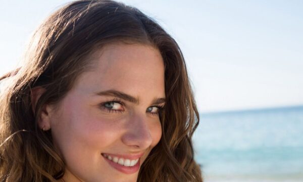 Scalp Sunscreens: Επαναστατικές αντηλιακές φόρμουλες για θωράκιση του τριχωτού της κεφαλής