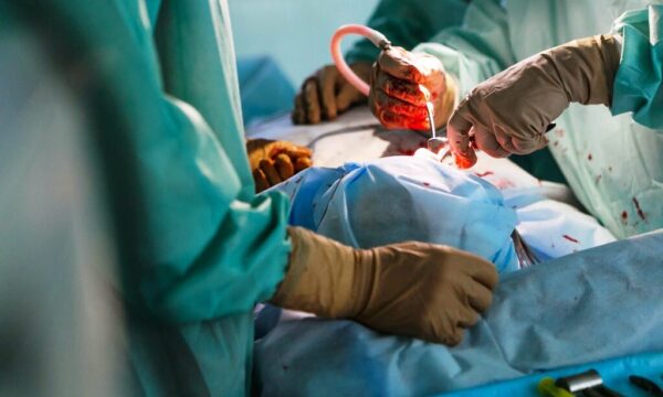 Πραγματοποιήθηκε η πρώτη επαναστατική μεταμόσχευση ουροδόχου κύστης παγκοσμίως!