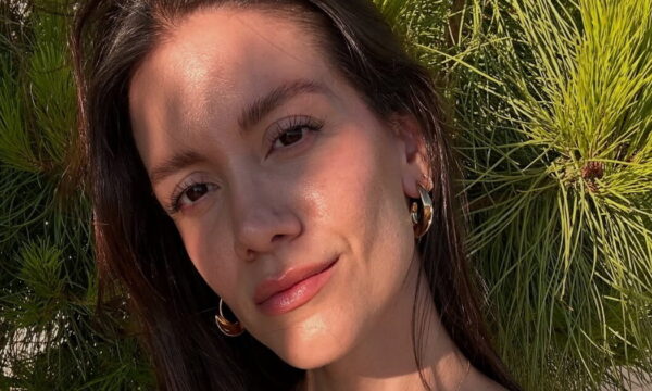 Νίκη Θωμοπούλου: «Από τα 13 μου υπέφερα – Σε παρόμοιες δερματικές φλεγμονές είναι κρίσιμο να βρεις τον κατάλληλο δερματολόγο»