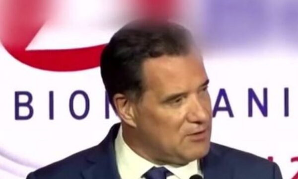 Άδωνις Γεωργιάδης: Η αντίδραση για τις αισθητικές επεμβάσεις – «Έκανα μπότοξ και έβαλα μαλλιά»