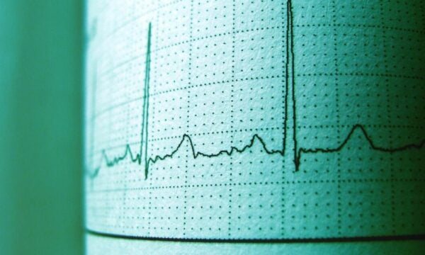 Πώς αντιδρά το σώμα μας στο τέλος της ζωής – Γιατρός αποκαλύπτει τις τελευταίες στιγμές μας