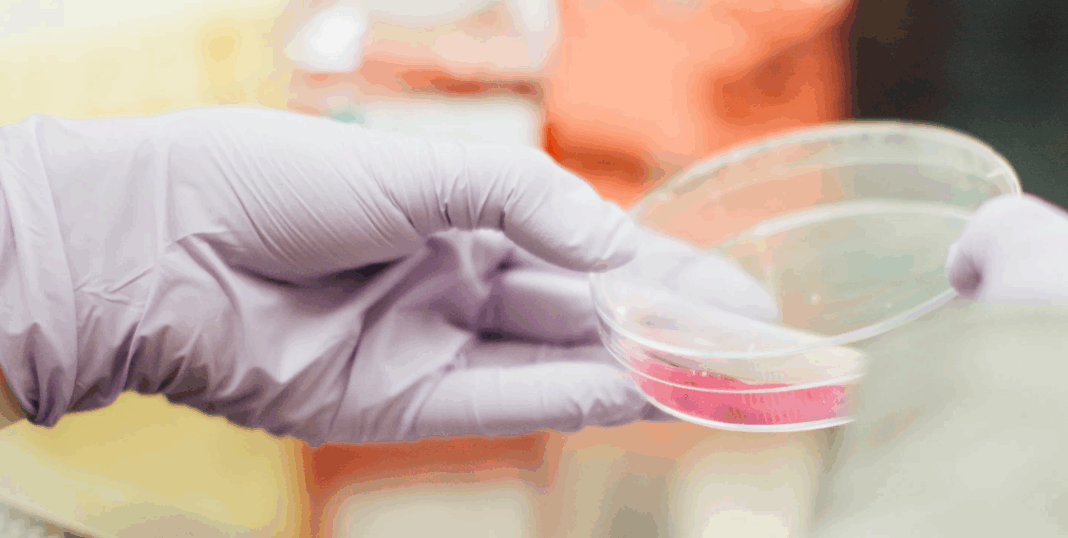 καρκίνος-του-μαστού-2