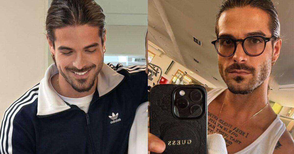 Άρης Μουγκοπέτρος: Αποκαλύπτει για πρώτη φορά τα δύο νέα δάχτυλα μετά τον ακρωτηριασμό του