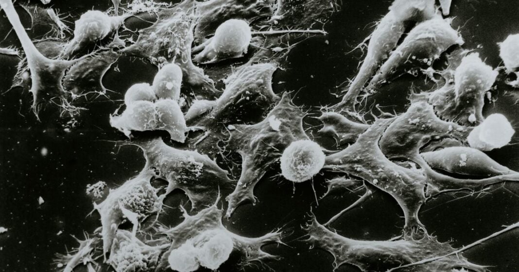 Καρκίνος-1200x630