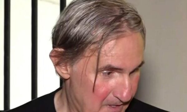 Άκης Σακελλαρίου: Έχουν μείνει ακόμα προβλήματα μετά το ατύχημα με τη μηχανή