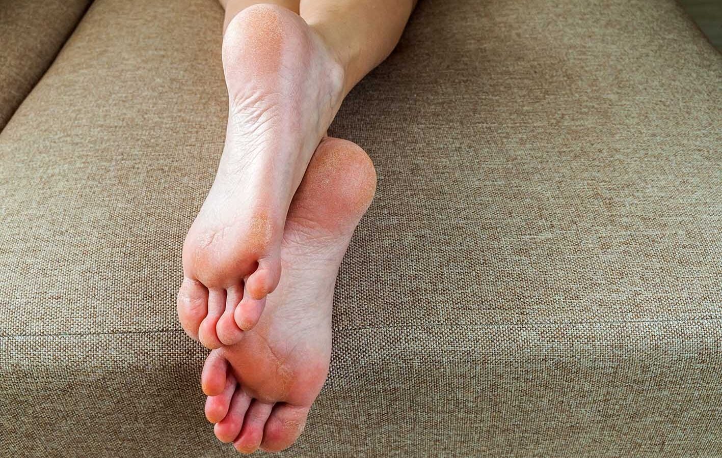 Ozempic feet: Η νέα αλλαγή στο σώμα που αναφέρουν όσοι χάνουν πολλά κιλά