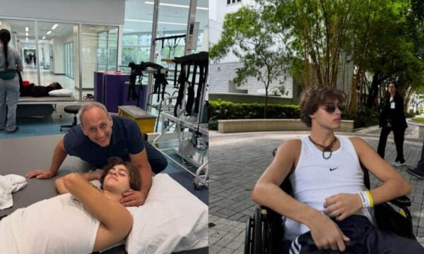 Σταύρος Φλώρος: Δείχνει το κομμένο πόδι του 3 μήνες μετά το ατύχημα – Εικόνες