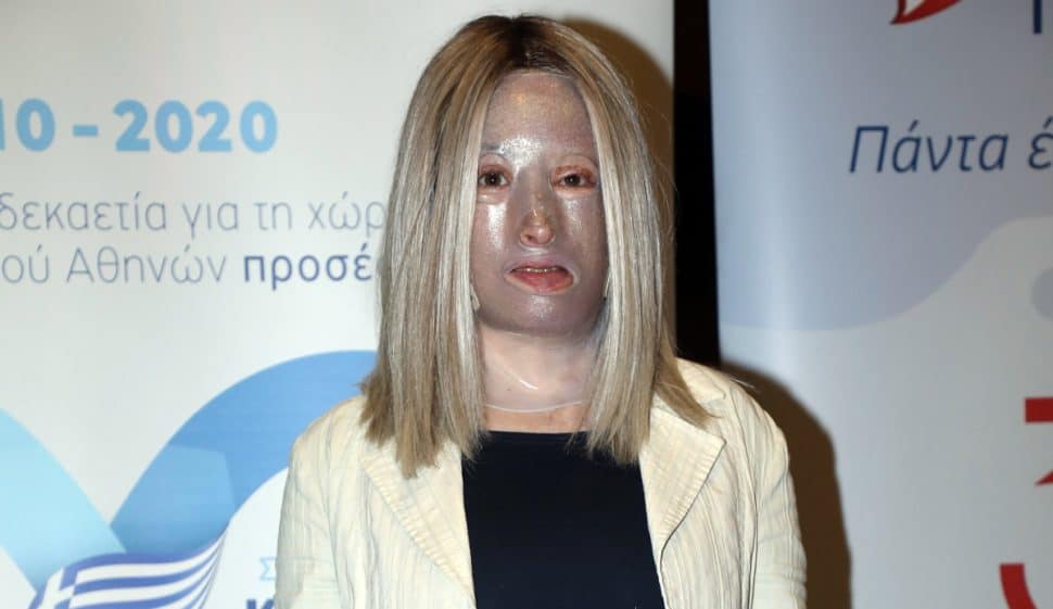 Ιωάννα Παλιοσπύρου: Απαντά στο πώς βιοπορίζεται – «Είμαι συνταξιούχος ανάπηρη»