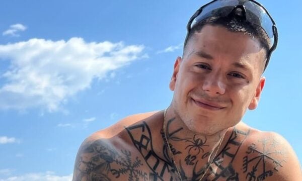 Mike: Η φωτογραφία μετά την επέμβαση στο πόδι του και η ανάρτηση μετά το τροχαίο