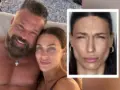 Βαλεντίνη Παπαδάκη: Έκανε μπότοξ και δείχνει το αποτέλεσμα στο πρόσωπό της