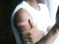 Νησιά Φίτζι σε κατάσταση έκτακτης ανάγκης λόγω HIV – Ένας στους 60 έχει AIDS