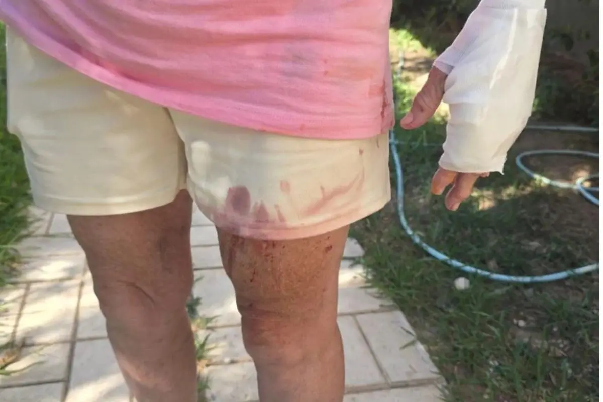 Ποινική δίωξη στη θεία του Στέφανου Τσιτσιπά για την επίθεση των σκύλων στη Βάρη
