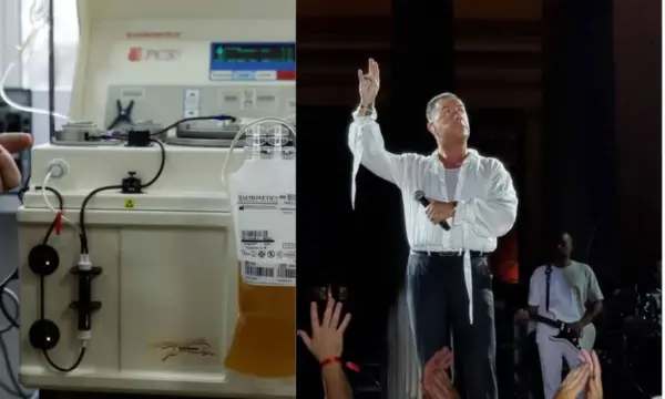 Γιώργος Μαζωνάκης: Τι είναι η πλασμαφαίρεση που έκανε στην κλινική του Κολωνακίου